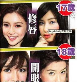 杭州整容爆料事件视频播放